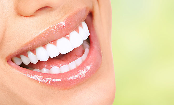 Clareamento Dental - Simioni Clínica Odontológica