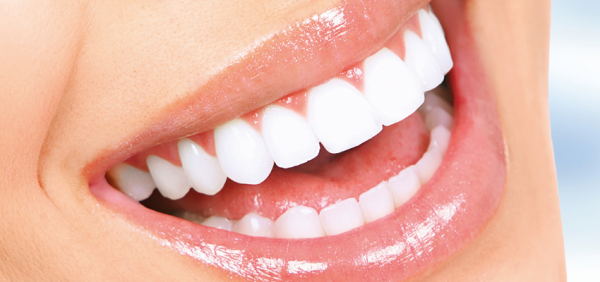 Lentes De Contato Para Os Dentes - Simioni Clínica Odontológica